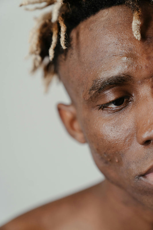 Get to know more about acne