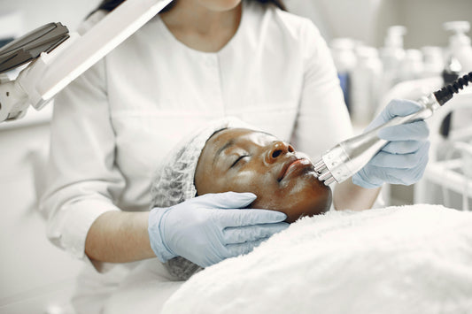 Laser Resurfacing for Acne Scars